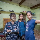 Amable y esponjoso: Un niño de 13 años de la India sufre del "síndrome del hombre lobo"