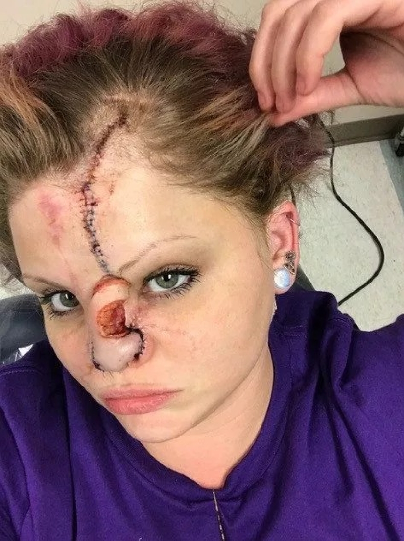 Amor desfigurado: un pitbull le mordió la nariz a una niña, pero ella lo perdonó y continúa acurrucándose con perros Amor desfigurado: un pitbull le mordió la nariz a una niña, pero ella lo perdonó y continúa acurrucándose con perros