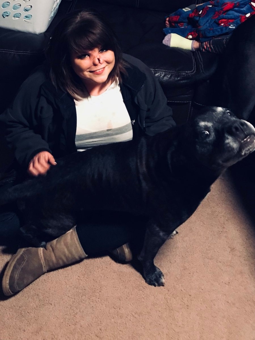 Amor desfigurado: un pitbull le mordió la nariz a una niña, pero ella lo perdonó y continúa acurrucándose con perros Amor desfigurado: un pitbull le mordió la nariz a una niña, pero ella lo perdonó y continúa acurrucándose con perros