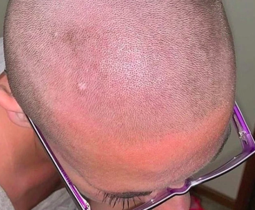 An American woman, having washed her head with a popular shampoo, was forced to contact the police