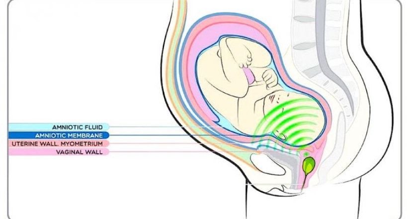 An Extravagant Way to spend $150: a vaginal player for moms of future geniuses