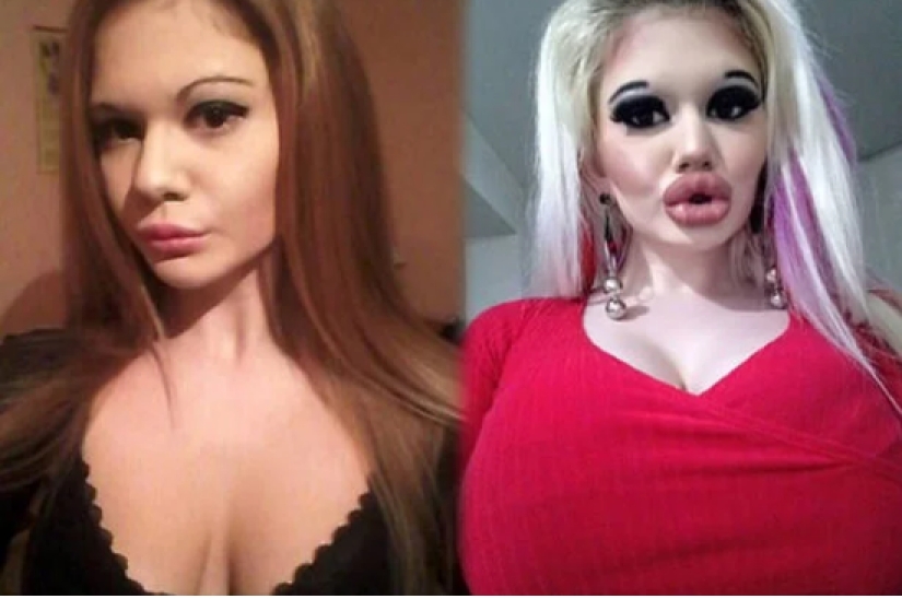 Ansia de belleza: estudiante búlgara agranda sus labios y no puede parar Ansia de belleza: estudiante búlgara agranda sus labios y no puede parar