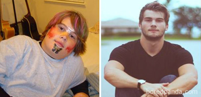 Antes y después: cómo se transforman los antiguos "patitos feos" Antes y después: cómo se transforman los antiguos "patitos feos"