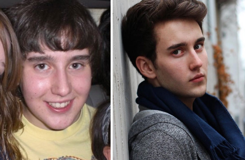 Antes y después: cómo se transforman los antiguos "patitos feos" Antes y después: cómo se transforman los antiguos "patitos feos"