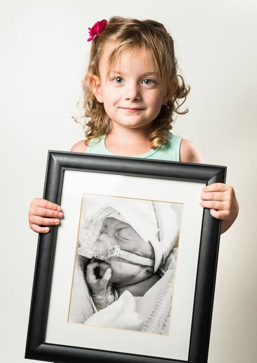Antes y después: fotos fuertes de niños que nacieron prematuramente