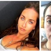 Apartment killer: the girl almost died from mold on the walls of the house