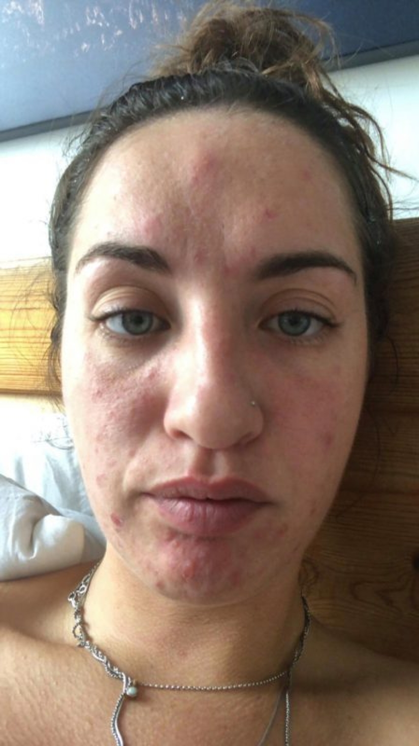 Apartment killer: the girl almost died from mold on the walls of the house Apartment killer: the girl almost died from mold on the walls of the house