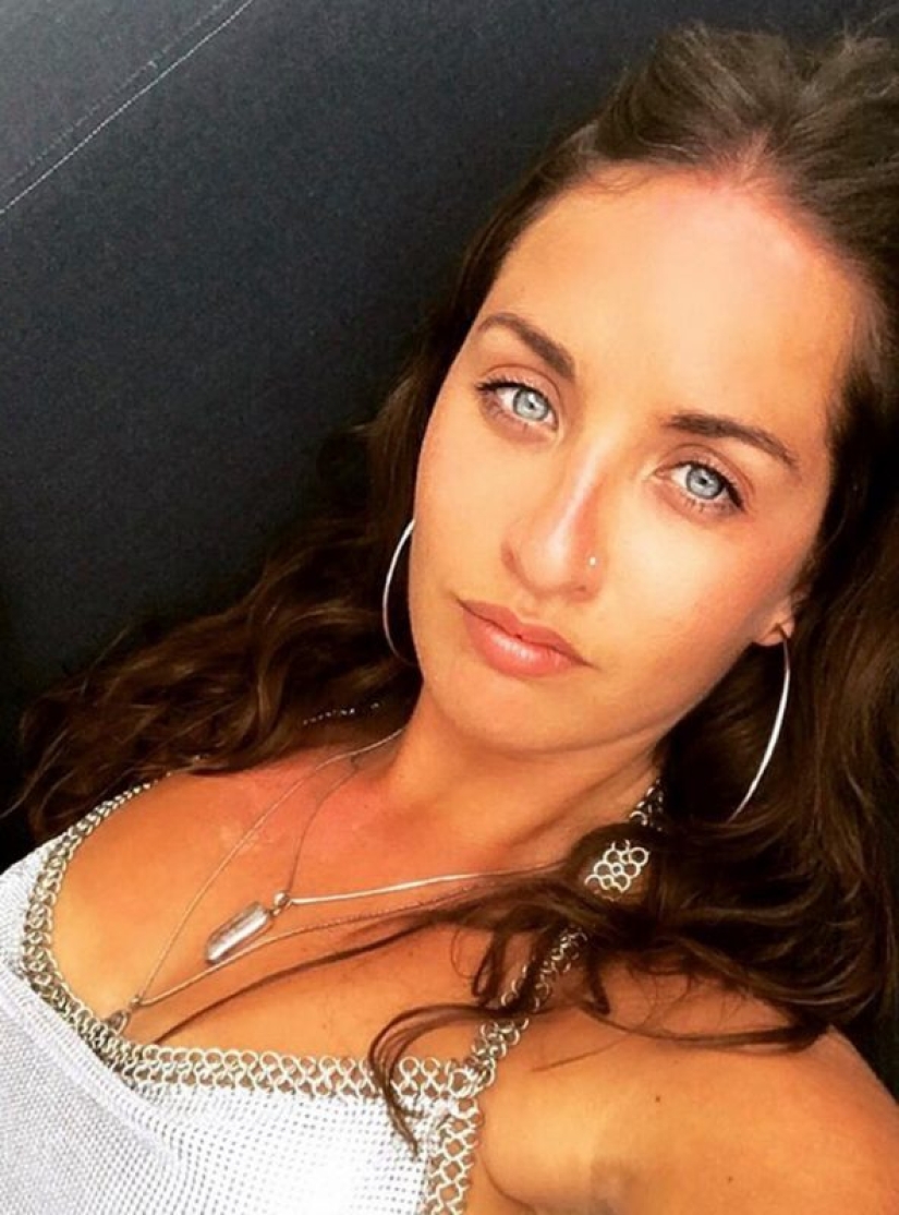 Apartment killer: the girl almost died from mold on the walls of the house Apartment killer: the girl almost died from mold on the walls of the house