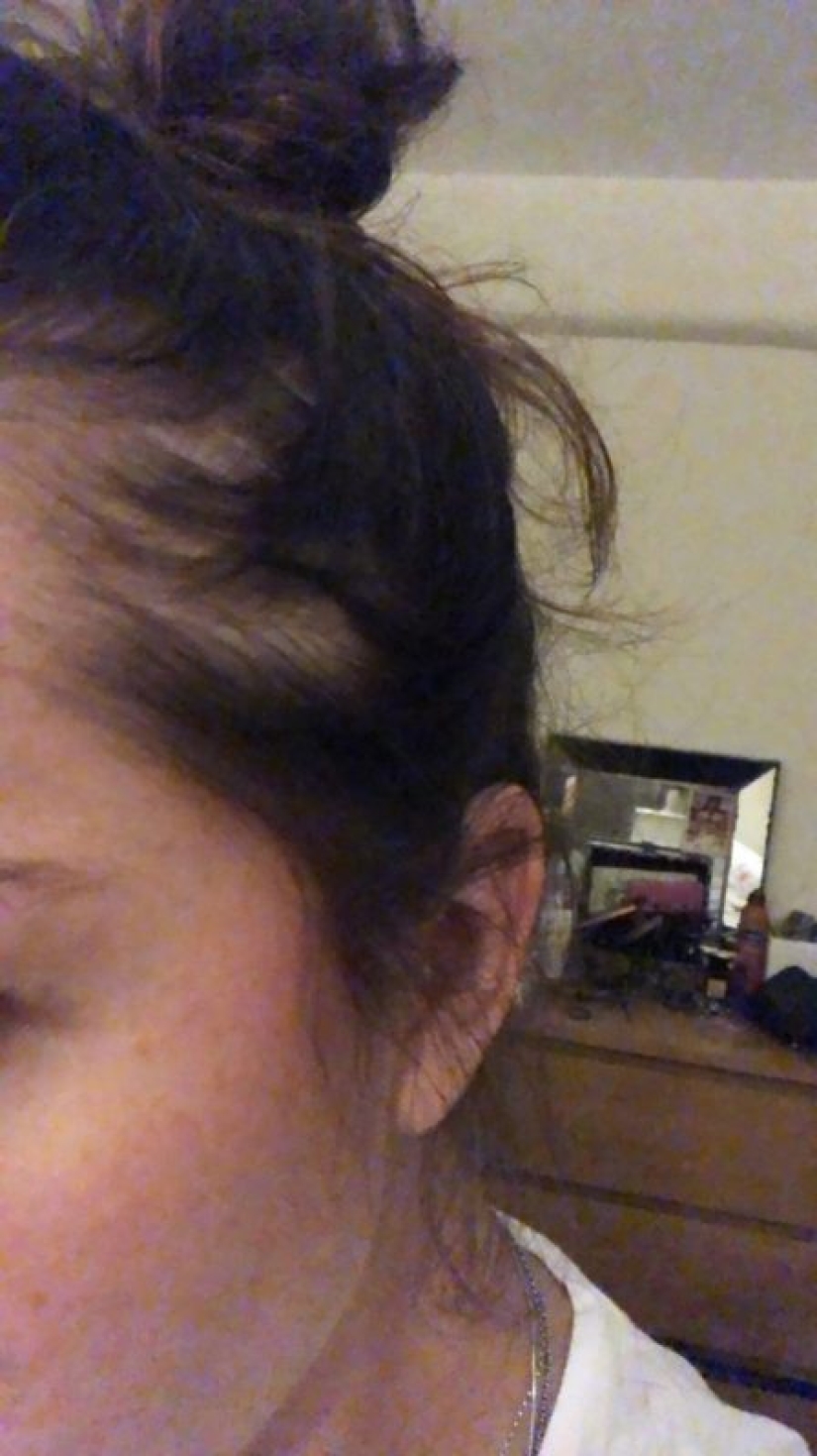 Apartment killer: the girl almost died from mold on the walls of the house Apartment killer: the girl almost died from mold on the walls of the house