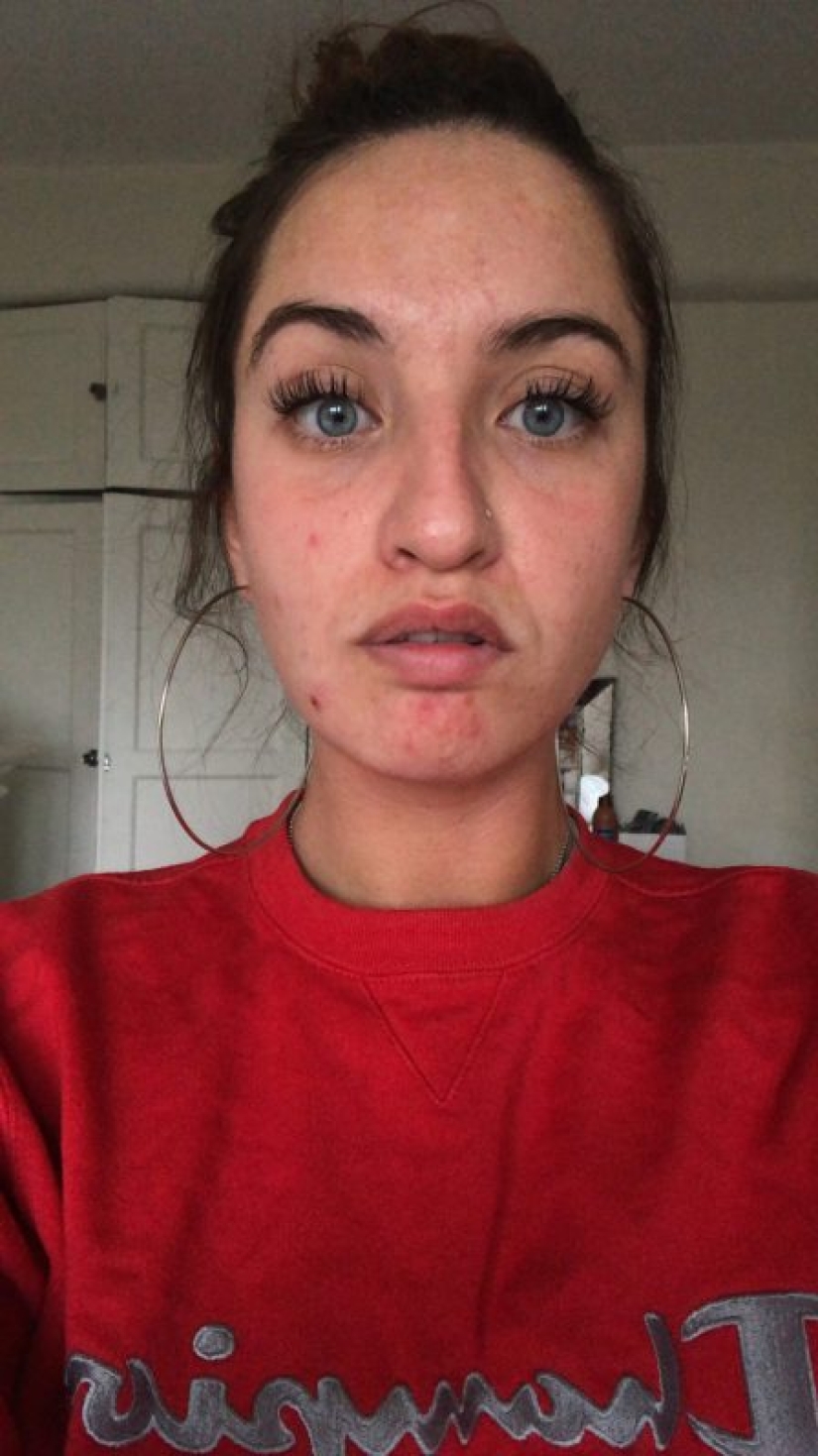 Apartment killer: the girl almost died from mold on the walls of the house Apartment killer: the girl almost died from mold on the walls of the house