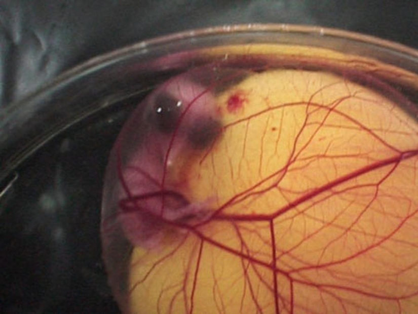 As the egg develops chicken As the egg develops chicken