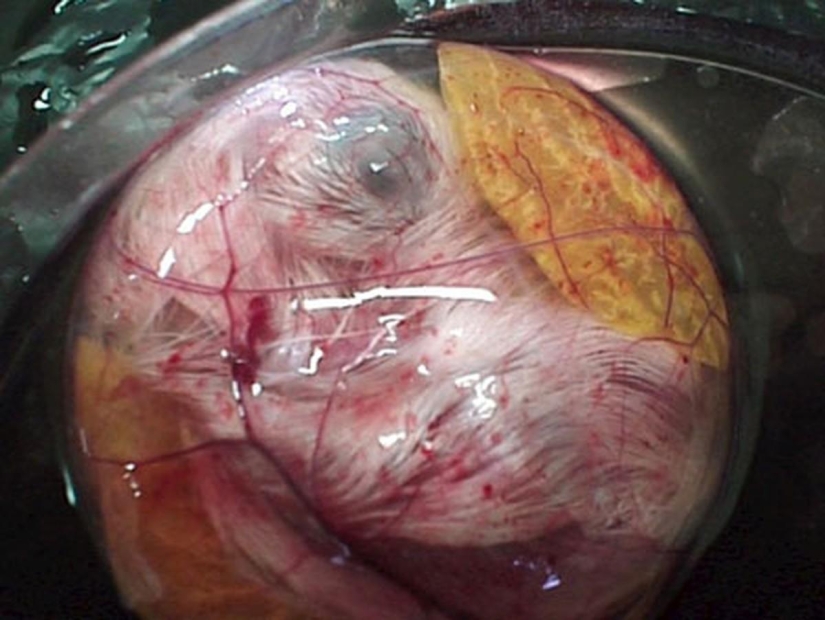 As the egg develops chicken As the egg develops chicken