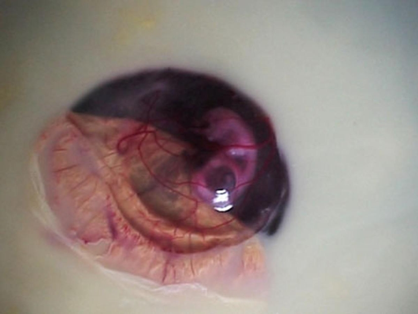 As the egg develops chicken As the egg develops chicken