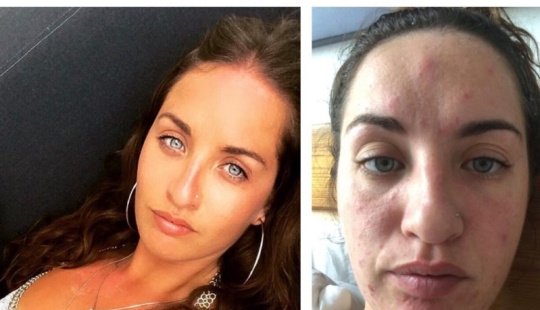 Asesino de apartamentos: la niña casi muere de moho en las paredes de la casa Asesino de apartamentos: la niña casi muere de moho en las paredes de la casa