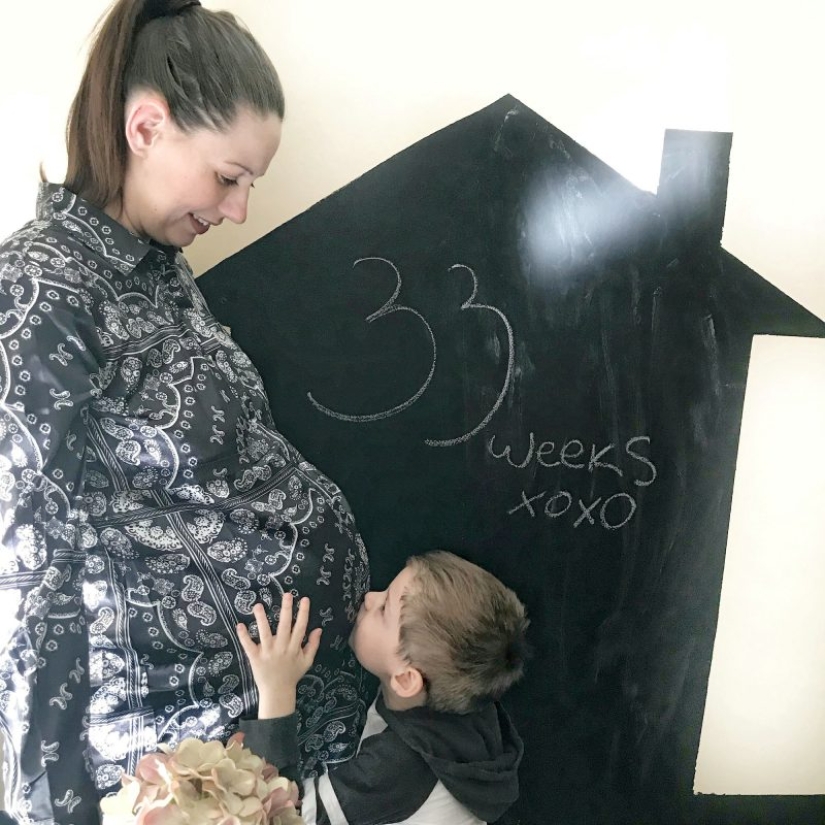 "Babies in a million": a British couple had unique twin girls "Babies in a million": a British couple had unique twin girls