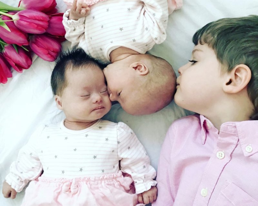 "Babies in a million": a British couple had unique twin girls "Babies in a million": a British couple had unique twin girls