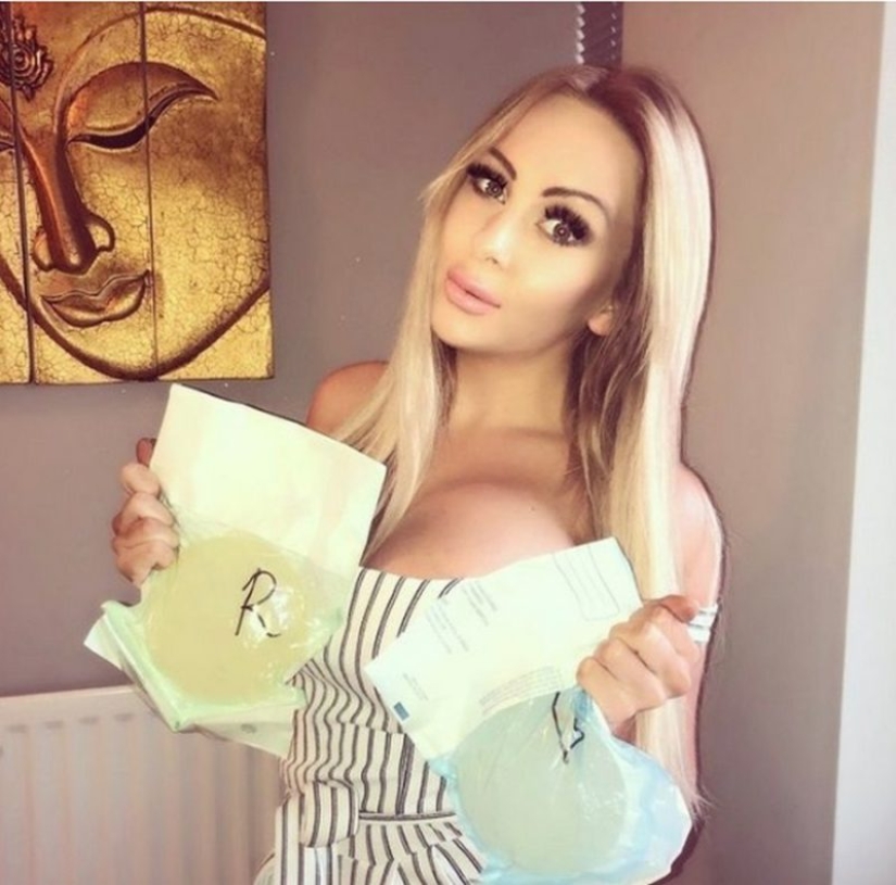"Balls with a juicy story": to increase the bust, a porn model sells her old implants