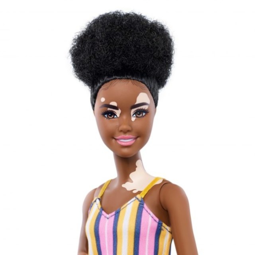 Barbie without hair, with vitiligo and prosthetics: Mattel to release inclusive dolls