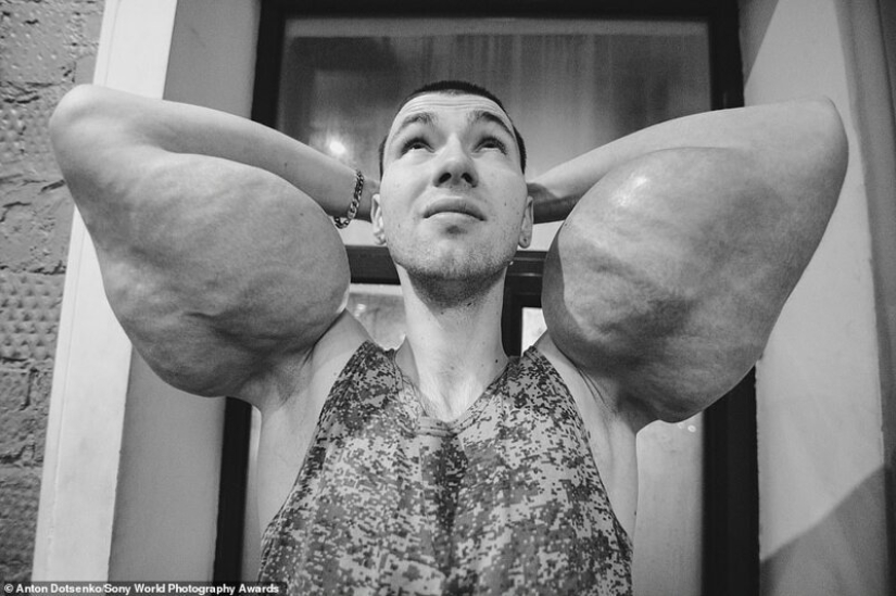 Bazooka hands and other pictures from the Sony World Photography Award 2020 shortlist Bazooka hands and other pictures from the Sony World Photography Award 2020 shortlist