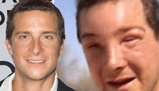 Bear Grylls estuvo al borde de la vida o la muerte durante el rodaje de nuevos episodios del programa