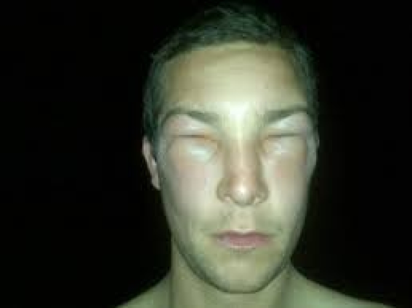 Bear Grylls was on the verge of life and death during the filming of new episodes of the program