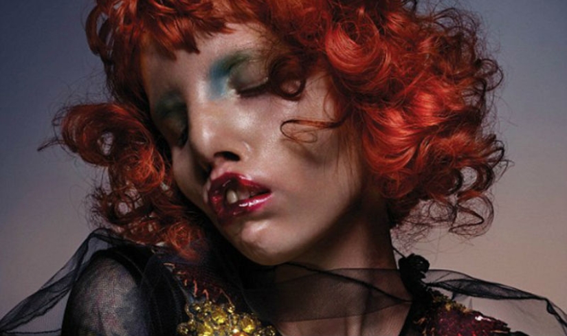 Beauty is not for everyone: a model with cat's eye syndrome