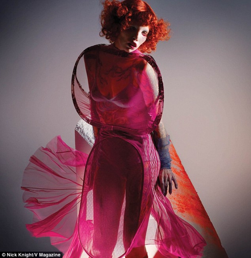 Beauty is not for everyone: a model with cat's eye syndrome