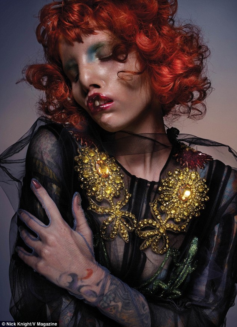 Beauty is not for everyone: a model with cat's eye syndrome