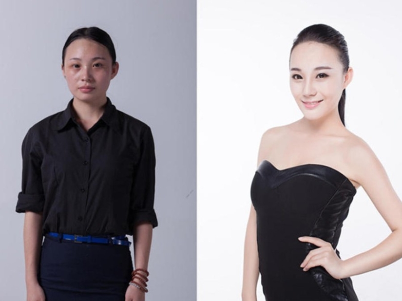 Beauty standards: Chinese women after plastic surgery