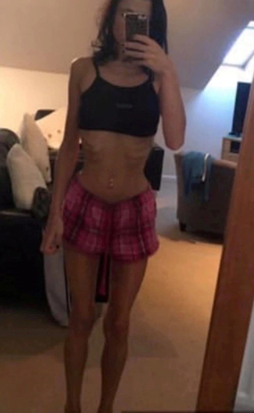 Bebida que salva vidas: las vacaciones con amigos en el resort salvaron a la niña de la anorexia