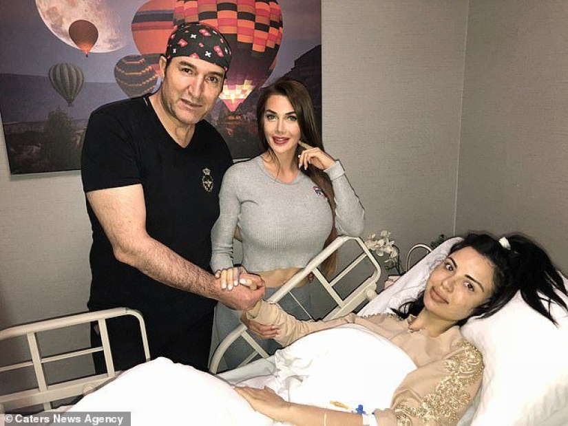 Belleza explosiva: la modelo gastó medio millón de dólares para parecerse a Kim Kardashian y casi muere