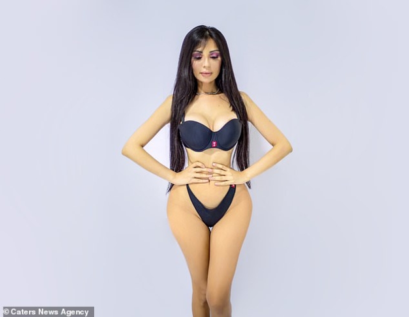 Belleza explosiva: la modelo gastó medio millón de dólares para parecerse a Kim Kardashian y casi muere