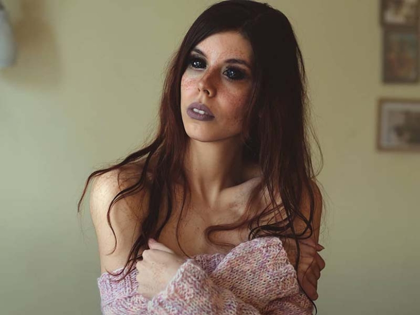 Black eyes: model from Poland went blind after tattooing eyeballs Black eyes: model from Poland went blind after tattooing eyeballs