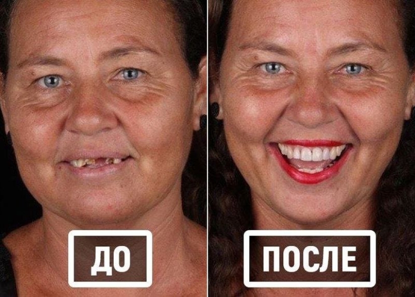 Brazilian dentist helps poor people shine with a snow-white smile