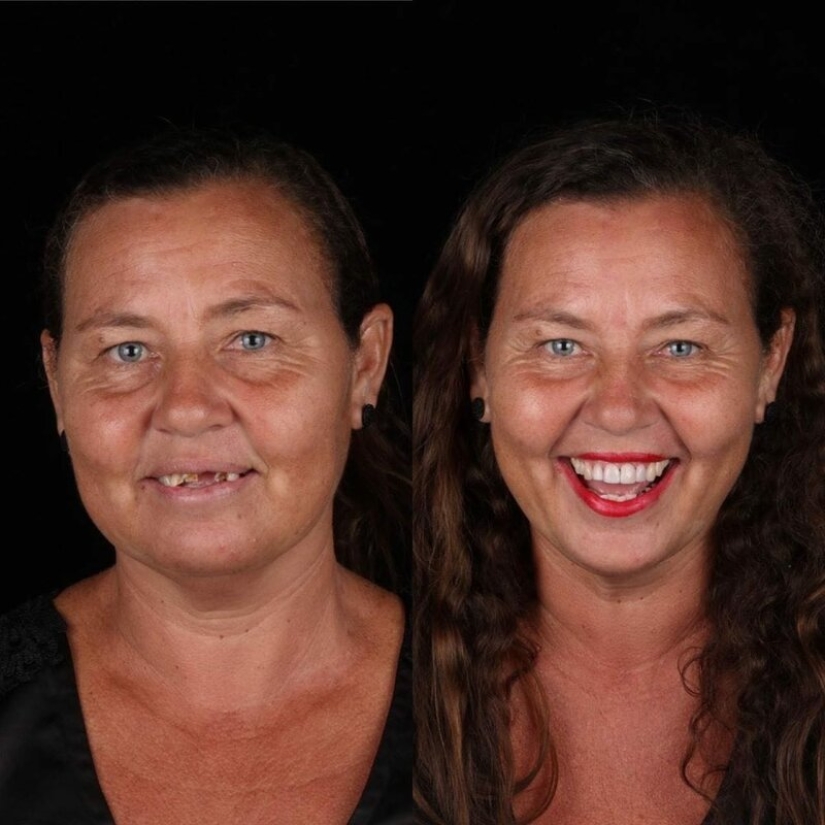 Brazilian dentist helps poor people shine with a snow-white smile