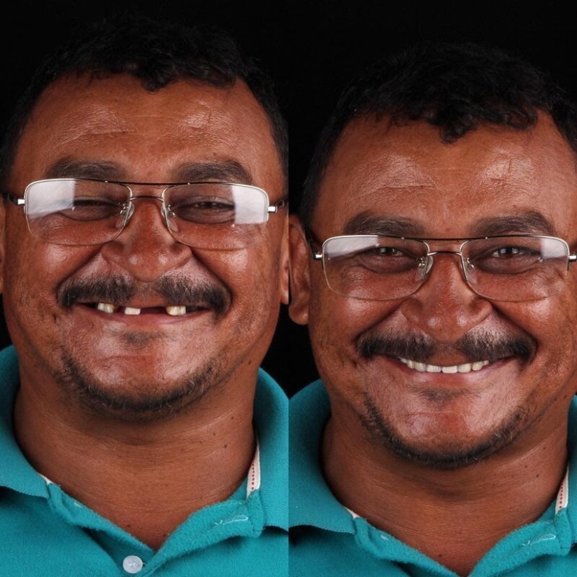 Brazilian dentist helps poor people shine with a snow-white smile