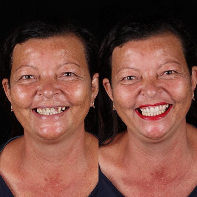 Brazilian dentist helps poor people shine with a snow-white smile