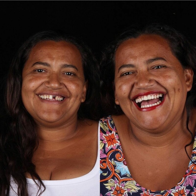 Brazilian dentist helps poor people shine with a snow-white smile