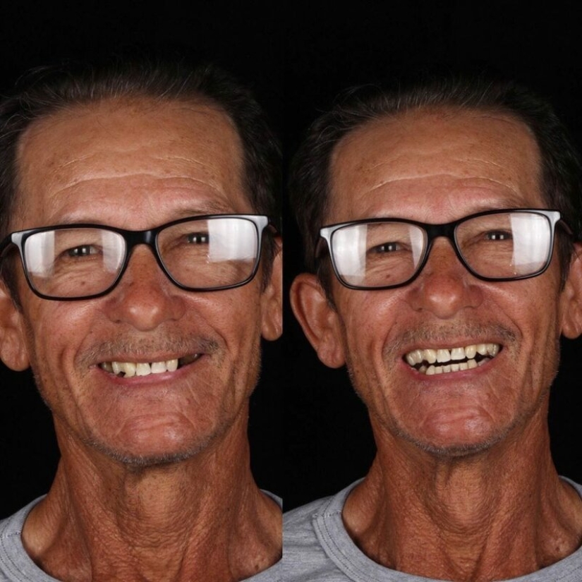 Brazilian dentist helps poor people shine with a snow-white smile