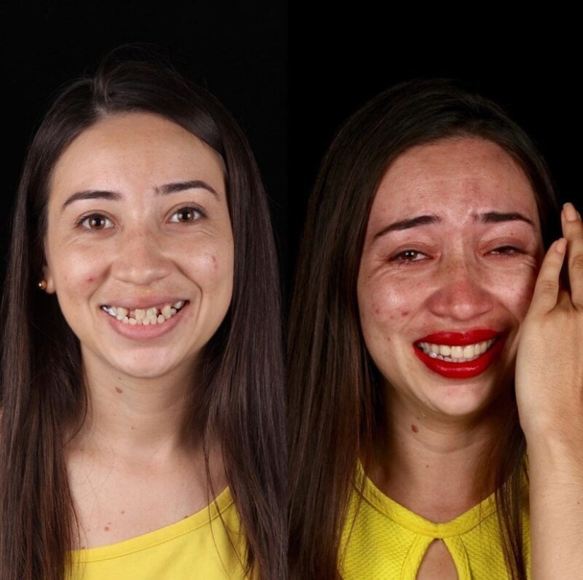 Brazilian dentist helps poor people shine with a snow-white smile