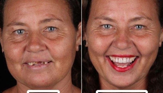 Brazilian dentist helps poor people shine with a snow-white smile Brazilian dentist helps poor people shine with a snow-white smile