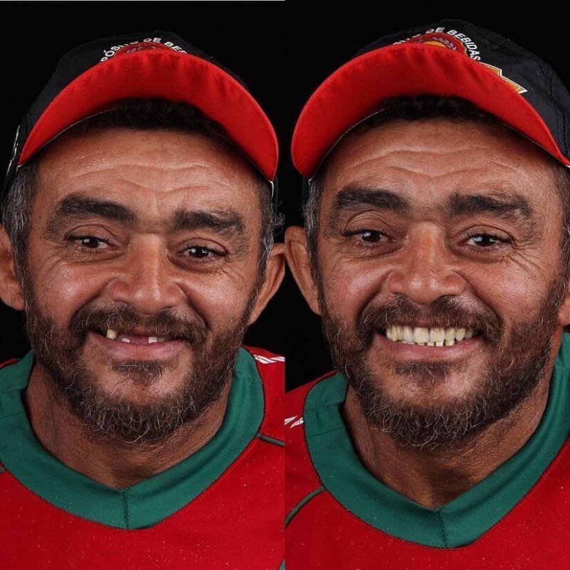 Brazilian dentist helps poor people shine with a snow-white smile