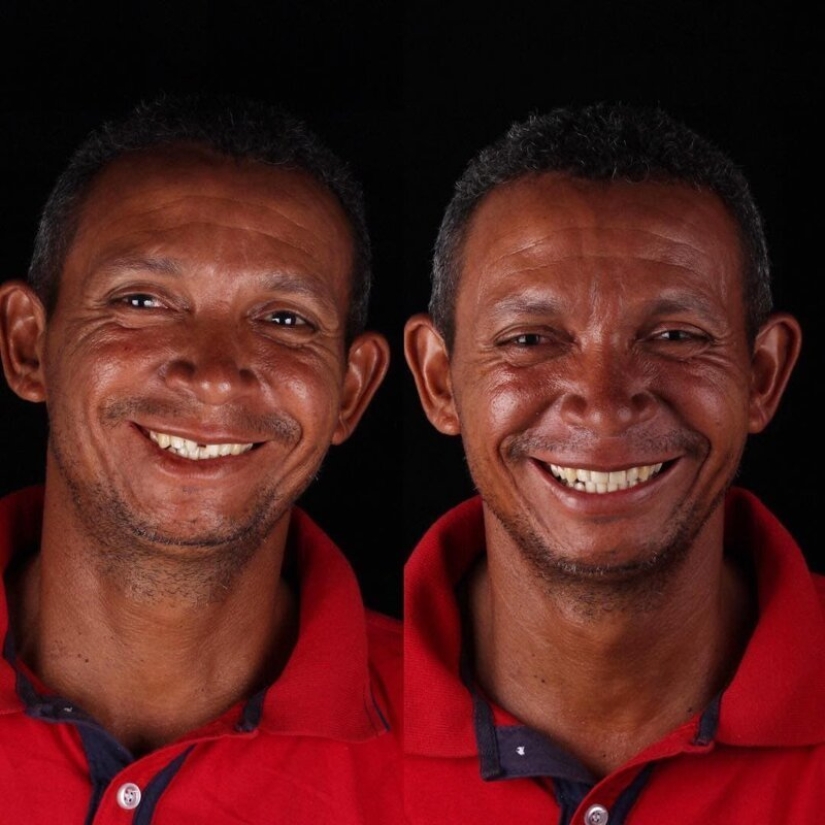 Brazilian dentist helps poor people shine with a snow-white smile
