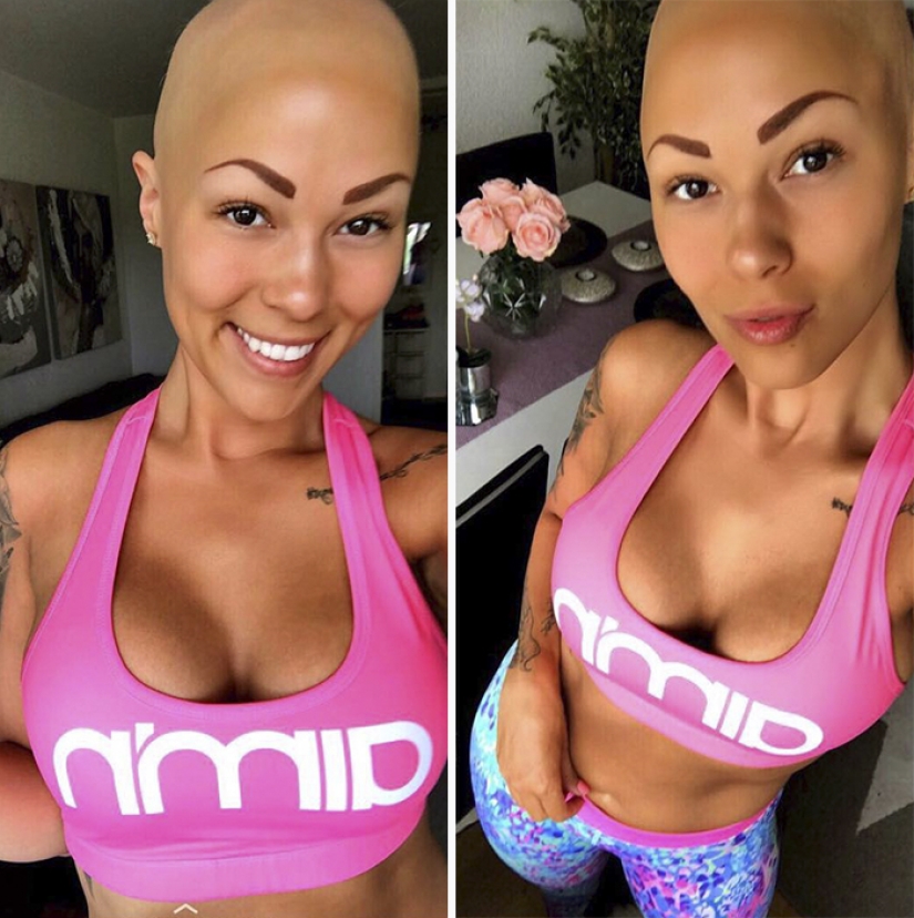 Brilliant: how a bald girl stopped being shy and turned into a star