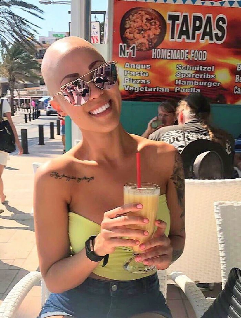Brilliant: how a bald girl stopped being shy and turned into a star