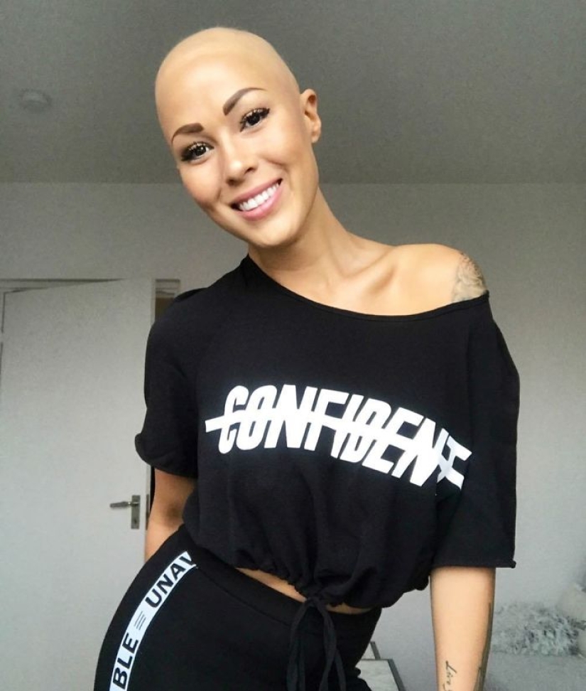 Brilliant: how a bald girl stopped being shy and turned into a star