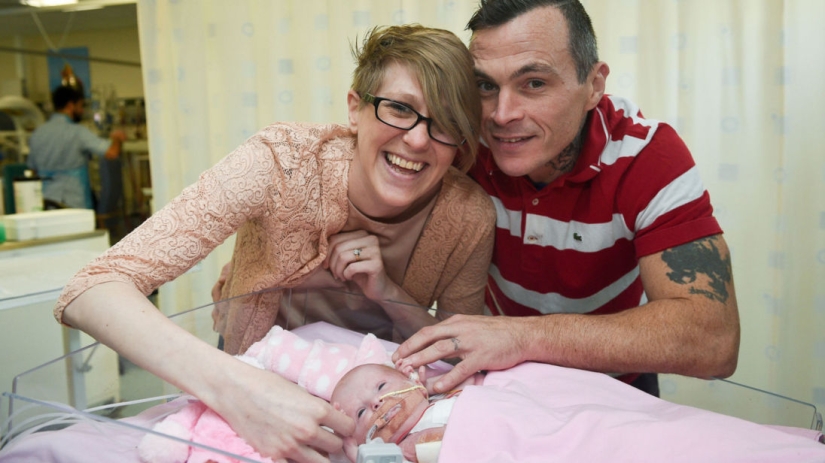 British doctors saved a baby girl who was born with her heart out British doctors saved a baby girl who was born with her heart out