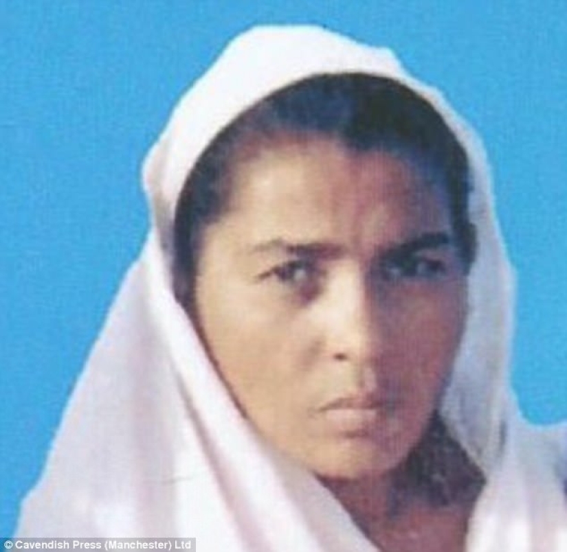 British surgeon performs free eyebrow transplantation for acid attack victims