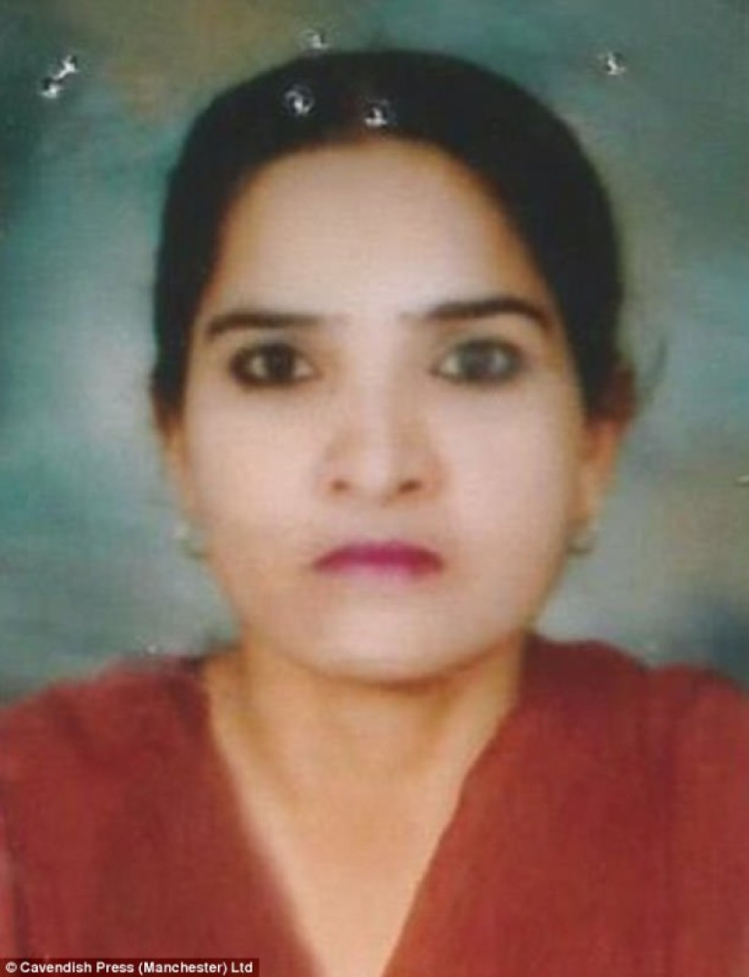 British surgeon performs free eyebrow transplantation for acid attack victims