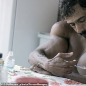 Bulbosaurus from Brazil: former drug addict gives himself oil injections